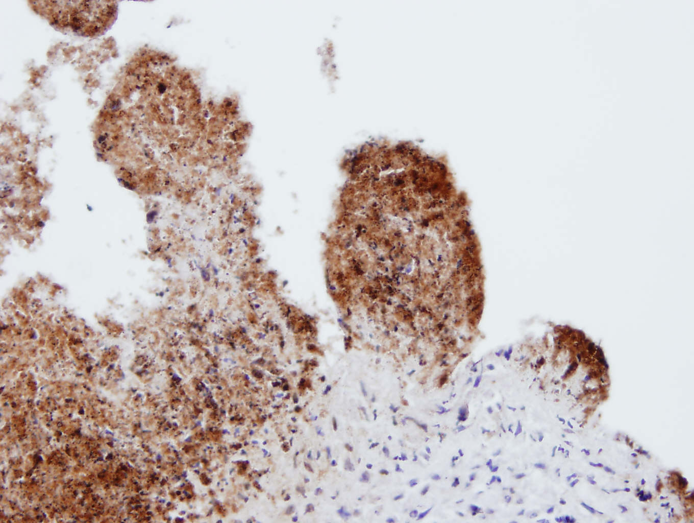 Figure 1. Expression of the chemokine CXCL8 in an inflamed placenta from a sheep infected with C. abortus.